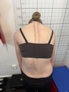 Manuálna terapia s cvičením/ Kombinovaná Terapia