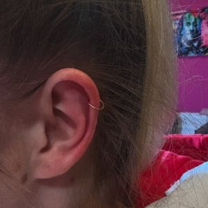 Helix, forward helix, flat