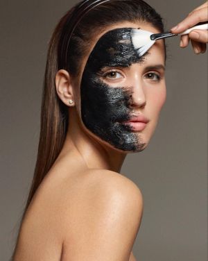 Hollywood Carbon Peel + Genesis Laser