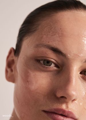 BioRePeelCl3 - Biostimulačný peeling pre omladenie a regeneráciu