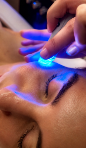 Hydrafacial + BioRePeel CI3 arc+nyak+dekoltázs