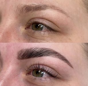 Lami a brow lift
