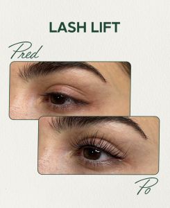 Lash Lift