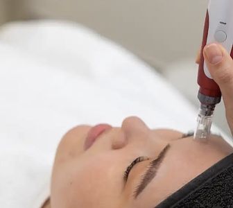Mezoterapia