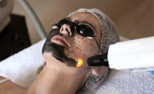 HOLLYWOOD PEEL